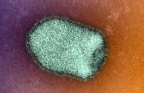 ep virus de la rabia