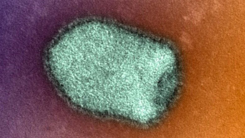 ep virus de la rabia