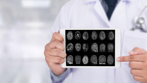 ep alzheimer 20181005175902