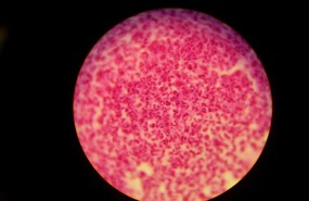 ep gonorrea neisseria gonorrhoeae