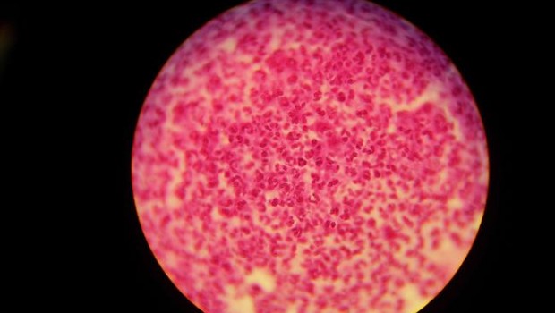 ep gonorrea neisseria gonorrhoeae