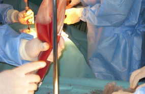 ep tecnicaextraccionmedula oseaquirofano