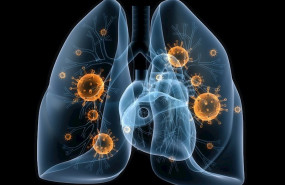 ep cancer de pulmon