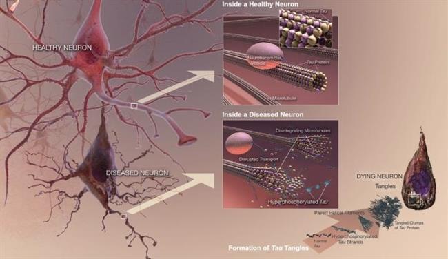 Enzimas en el cerebro | NATIONAL INSTITUTE ON AGING/NATIONAL INSTITUTES OF ep enzimascerebro