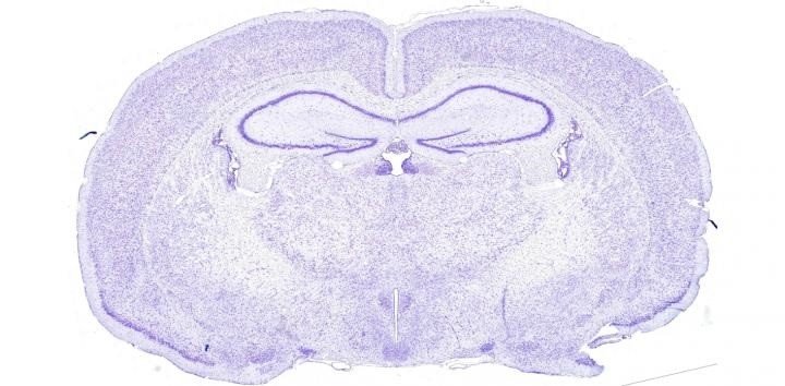 Sección transversal del cerebro de rata. Para asegurarse de que el núcleo supraquiasmático se había desactivado correctamente, los investigadores examinaron posteriormente varias histologías como ésta. | UNIVERSITY OF COPENHAGEN ep seccion transversal del cerebro de rata para asegurarse de que el nucleo supraquiasmatico se