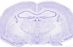 ep seccion transversal del cerebro de rata para asegurarse de que el nucleo supraquiasmatico se