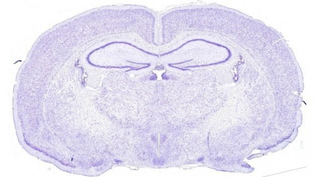 ep seccion transversal del cerebro de rata para asegurarse de que el nucleo supraquiasmatico se
