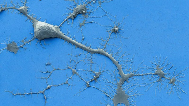 ep archivo   esta micrografia electronica de barrido coloreada muestra una neurona humana cultivada