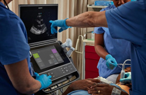 1597066308 eco grafo pocus sonosite px