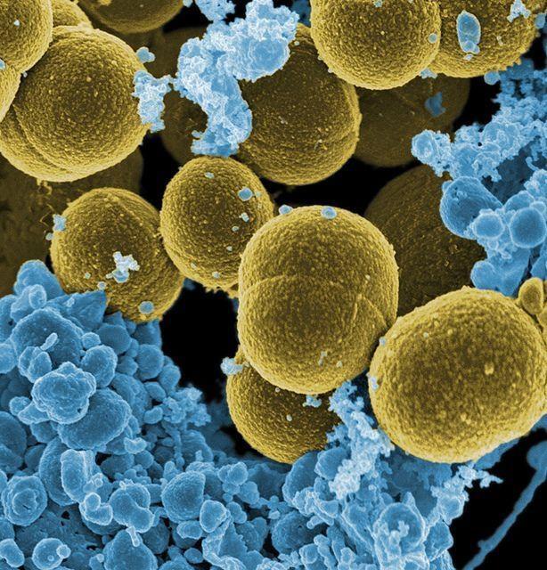 ep staphylococcus aureus bacteria