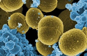 ep staphylococcus aureus bacteria