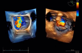 ep archivo ge healthcare presenta avances en ia para el diagnostico en cardiologia en congreso sec ep archivo ge healthcare presenta avances en ia para el diagnostico en cardiologia en congreso sec