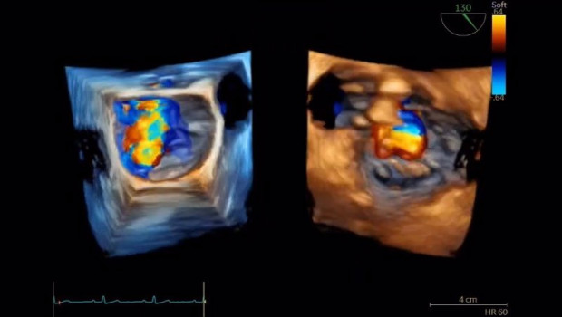 ep archivo   ge healthcare presenta avances en ia para el diagnostico en cardiologia en congreso sec