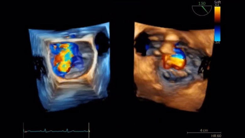 ep archivo   ge healthcare presenta avances en ia para el diagnostico en cardiologia en congreso sec