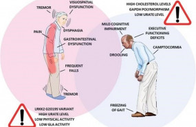 ep infografia de las diferencias en la sintomatologia del parkinson y factores de riesgo entre