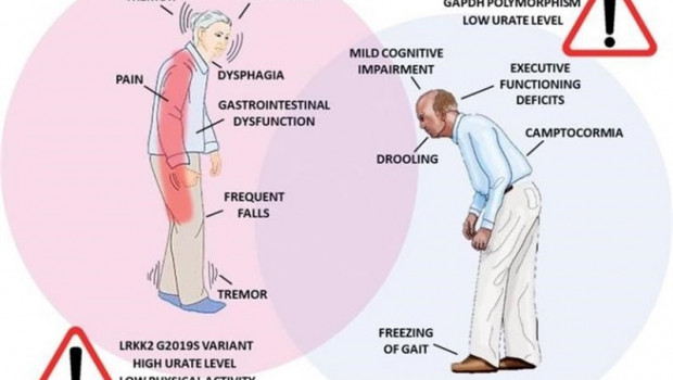 ep infografia de las diferencias en la sintomatologia del parkinson y factores de riesgo entre