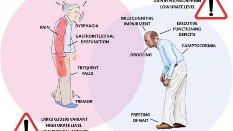 Infografía de las diferencias en la sintomatología del Parkinson y factores de riesgo entre mujeres y hombres | ARMANDO BARONE ep infografia de las diferencias en la sintomatologia del parkinson y factores de riesgo entre
