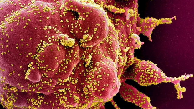 ep micrografia electronica de barrido coloreada de una celula apoptotica en rojo infectada con