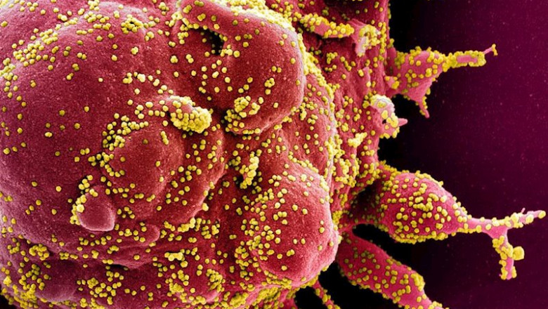 ep micrografia electronica de barrido coloreada de una celula apoptotica en rojo infectada con
