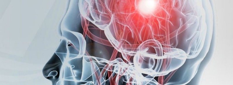 ep reconocimiento de las secuelas de un dano cerebral adquirido