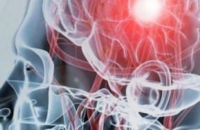 ep reconocimiento de las secuelas de un dano cerebral adquirido