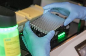 ep un analisissangre podria predecirresistenciacancerprostata