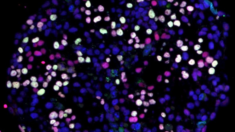 ep celulas madre pluripotentes humanas azul convirtiendose en celulas germinales humanas rosa y
