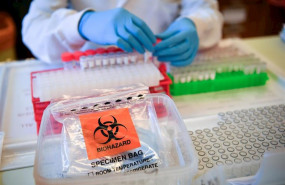 ep muestras del nuevo coronavirus