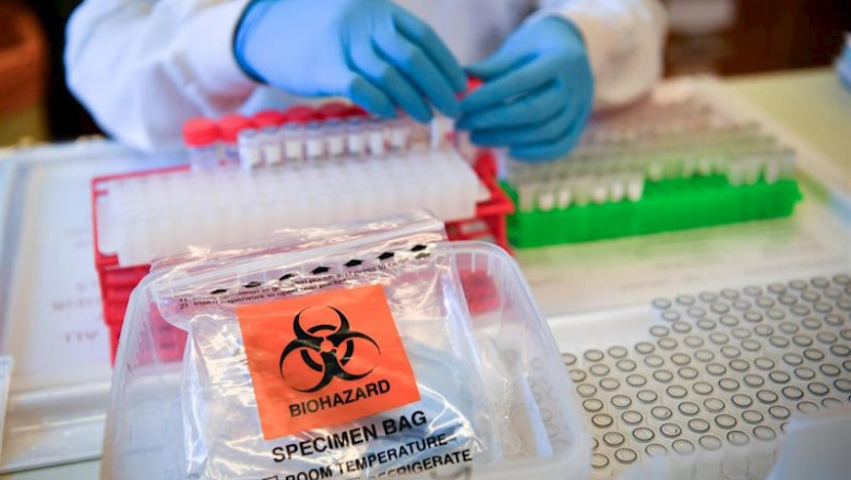 Muestras del nuevo coronavirus | Ben Birchall/PA Wire/dpa ep muestras del nuevo coronavirus