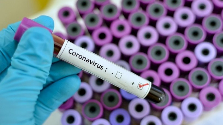 Terapia coronavirus | FARMAINDUSTRIA ep terapia coronavirus