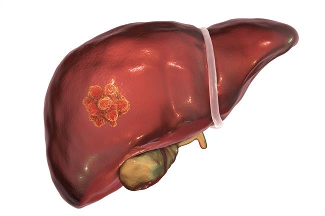 Estudio de investigadores de la USC sobre metástasis hepática. | USC ep estudioinvestigadoresla uscmetastasis hepatica