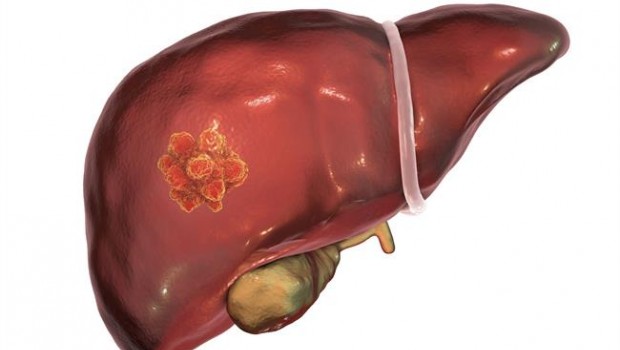 ep estudioinvestigadoresla uscmetastasis hepatica