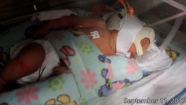 ep bebe prematuro 20171121183804