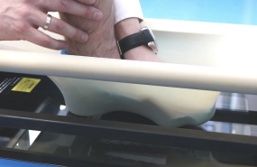 3d scan de podoactiva 2