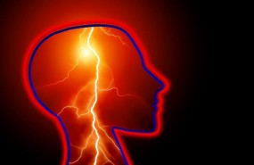 ep ictus dolorcabeza epilepsia
