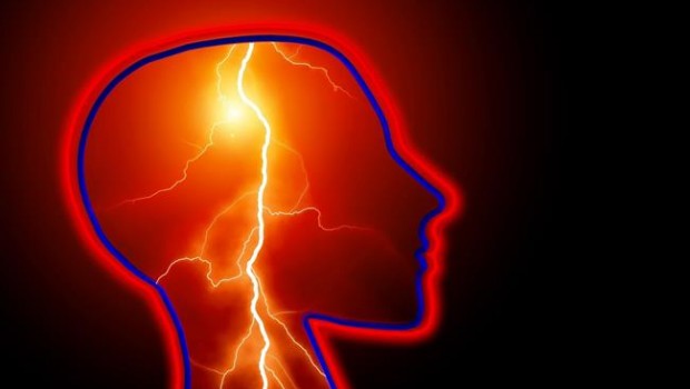 ep ictus dolorcabeza epilepsia