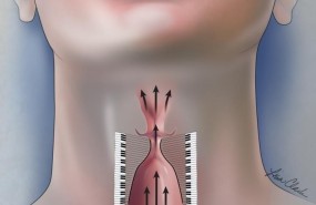 ep cuerdas vocales