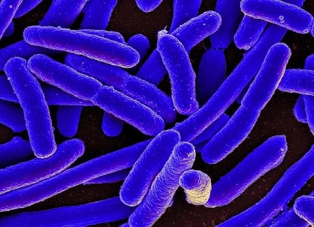 E. Coli Bacteria | NIAID/ FLICKR ep e coli bacteria