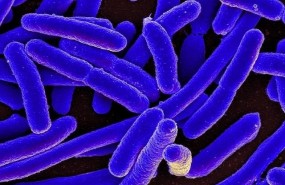 ep e coli bacteria