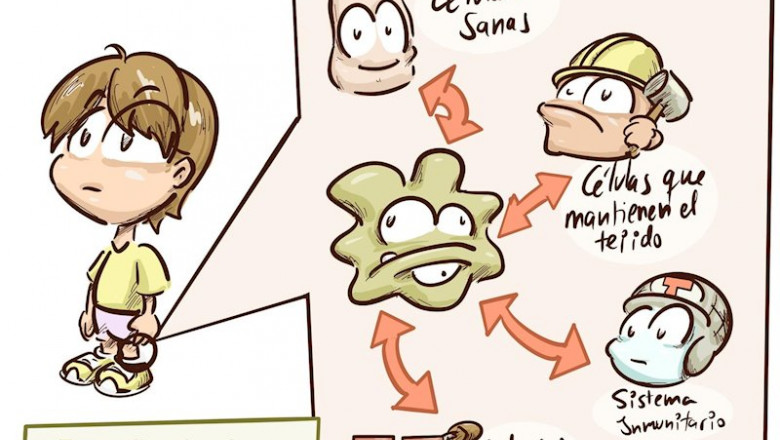 Infografía sobre el Sarcoma de Ewing | CRIS CONTRA EL CÁNCER ep infografia sobre el sarcoma de ewing