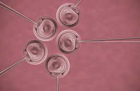 fecundacin asistida