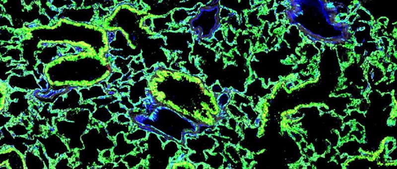 Imagen microscópica de uno de los pulmones en ratones. Las células madre trasplantadas brillan por la presencia de proteína verde fluorescente. | COLUMBIA UNIVERSITY IRVING MEDICAL CENTER ep imagen microscopica de uno de los pulmones en ratones las celulas madre trasplantadas brillan por