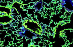 ep imagen microscopica de uno de los pulmones en ratones las celulas madre trasplantadas brillan por