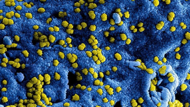 ep imagen microscopica electronica de escaneo digitalmente coloreada sem de las particulas del