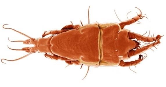 Ejemplar de ácaro de la especie ‘Trouessartia bifurcata’ | ESTACIÓN BIOLÓGICA DE DOÑANA ep ejemplar de acarola especie trouessartia bifurcata