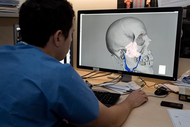 ep impresion 3dplanificar intervencioneshospital clinic