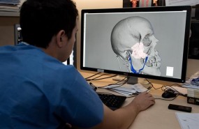 ep impresion 3dplanificar intervencioneshospital clinic