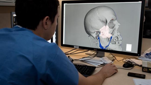 ep impresion 3dplanificar intervencioneshospital clinic
