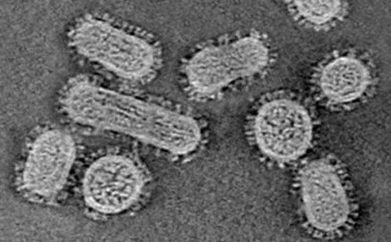 Sección de un tomograma de virus de la gripe de la cepa utilizada para el estudio. | CNB-CSIC ep seccion de un tomograma de virus de la gripe de la cepa utilizada para el estudio