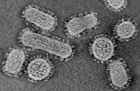 ep seccion de un tomograma de virus de la gripe de la cepa utilizada para el estudio